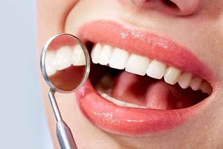 restoration dentists colorado springs bright white smile with mirror