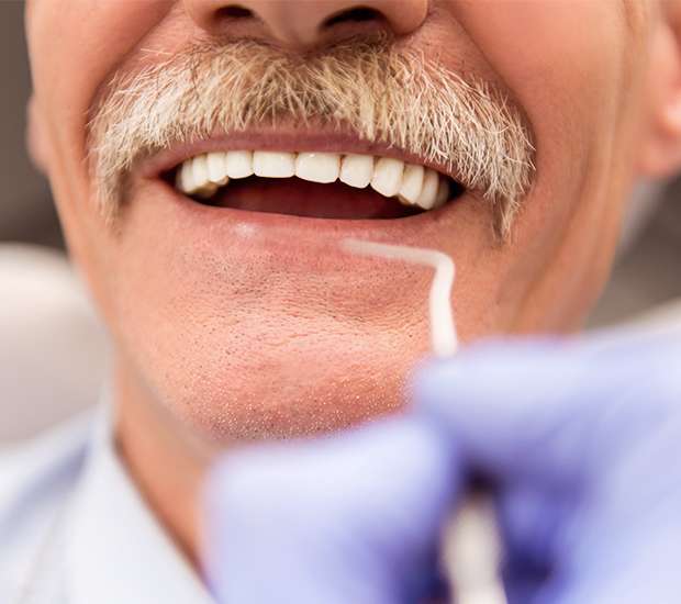 Colorado Springs Adjusting to New Dentures