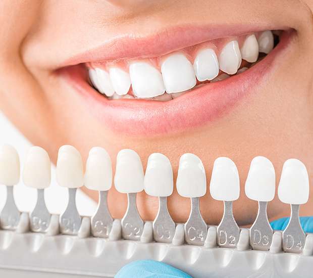 Colorado Springs Cosmetic Dentist