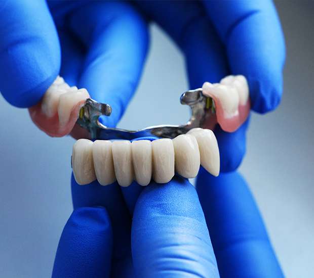Colorado Springs Dental Bridges