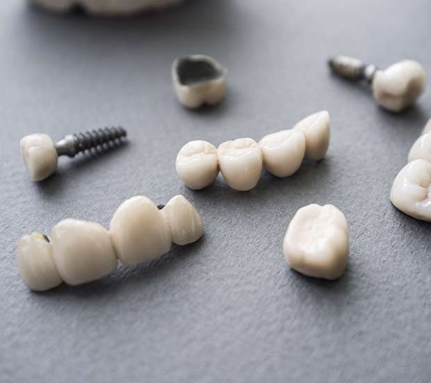 Colorado Springs The Difference Between Dental Implants and Mini Dental Implants